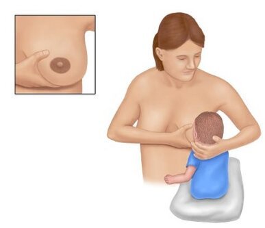 أساس الإطعام الناجح والمريح هو الإمساك الصحيح بطفل حلمة الأم. قبضة صحيحة تتضمن قبضة الحلمة ومعظم الهالات ، مما يخلق ضيقًا ، يسمح للطفل بمص وابتلاع الحليب بشكل مريح. أساس الإطعام الناجح والمريح هو الإمساك الصحيح بطفل حلمة الأم. قبضة صحيحة تتضمن قبضة الحلمة ومعظم الهالات ، مما يخلق ضيقًا ، يسمح للطفل بمص وابتلاع الحليب بشكل مريح.