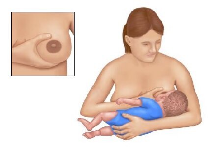 أساس الإطعام الناجح والمريح هو الإمساك الصحيح بطفل حلمة الأم. قبضة صحيحة تتضمن قبضة الحلمة ومعظم الهالات ، مما يخلق ضيقًا ، يسمح للطفل بمص وابتلاع الحليب بشكل مريح. أساس الإطعام الناجح والمريح هو الإمساك الصحيح بطفل حلمة الأم. قبضة صحيحة تتضمن قبضة الحلمة ومعظم الهالات ، مما يخلق ضيقًا ، يسمح للطفل بمص وابتلاع الحليب بشكل مريح.