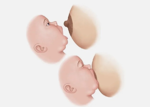 قبضة مناسبة تتجنب ظهور الشقوق ووجع الحلمات. فيما يلي بعض الأمثلة على المواقف التي تسمح بقبضة الحلمة المناسبة. قبضة مناسبة تتجنب ظهور الشقوق ووجع الحلمات. فيما يلي بعض الأمثلة على المواقف التي تسمح بقبضة الحلمة المناسبة.