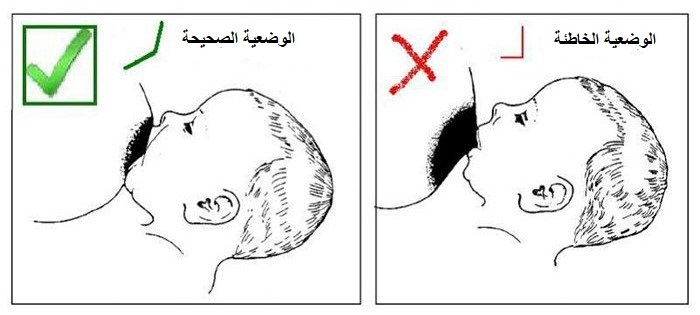 الوضعية الخاطئة والوضعية الصحيحة للرضاعة الطبيعية الصحية الوضعية الخاطئة والوضعية الصحيحة للرضاعة الطبيعية الصحية