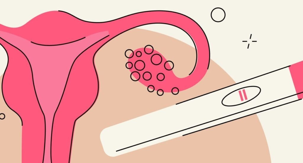 إليك 8 أنواع من شاي الأعشاب لعلاج متلازمة تكيس المبايض: