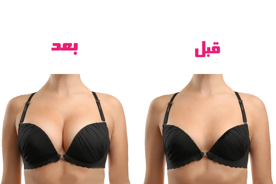 كيف يمكنني تكبير حجم الثدي لدي